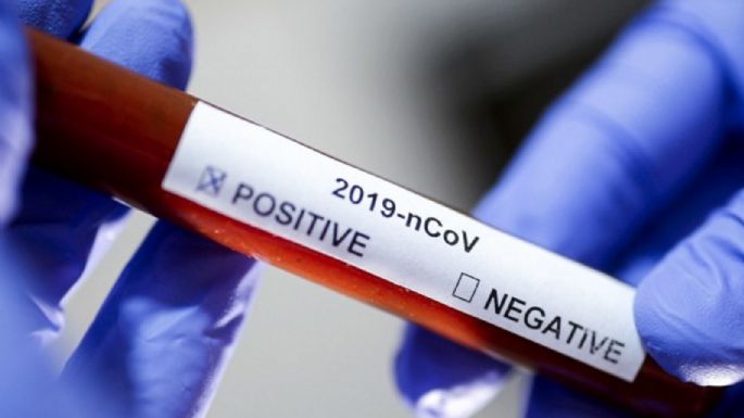 El coronavirus no se detiene en Zapala: confirman 25 nuevos casos positivos