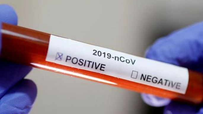 Coronavirus: ¿Positivo o negativo? El por qué los estudios arrojan distintos resultados...