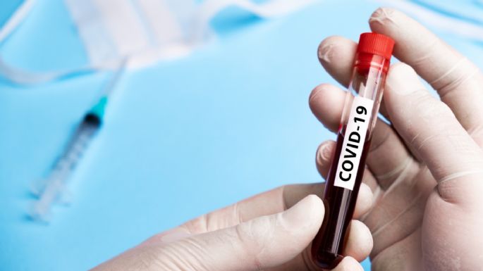Loncopué: el coronavirus analizado a través de 70 testeos