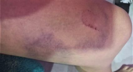 Una mujer que circulaba en bici fue atacada por una jauría de perros sueltos