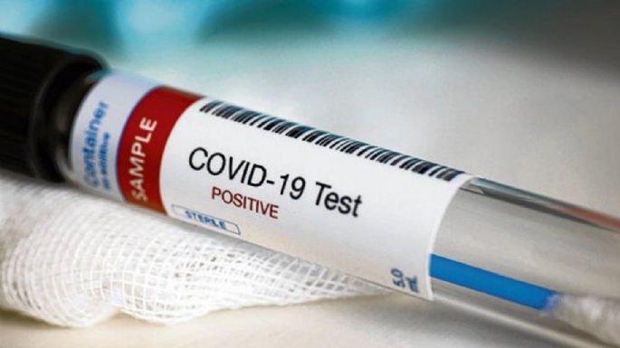 Zapala: jornada con alarmante incremento de casos positivos de coronavirus