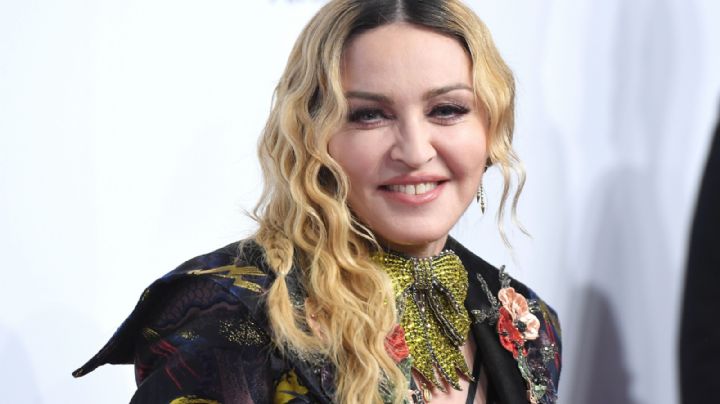 El notable cambio del rostro de Madonna, luego de varios retoques faciales para el olvido