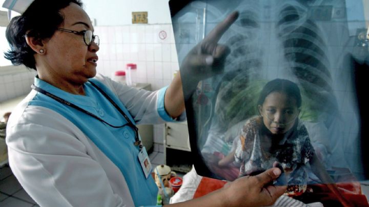 La OMS alertó sobre otra crisis sanitaria: la pandemia hizo subir las muertes por tuberculosis