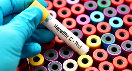 ANMAT aprobó un test de detección rápida para la hepatitis C