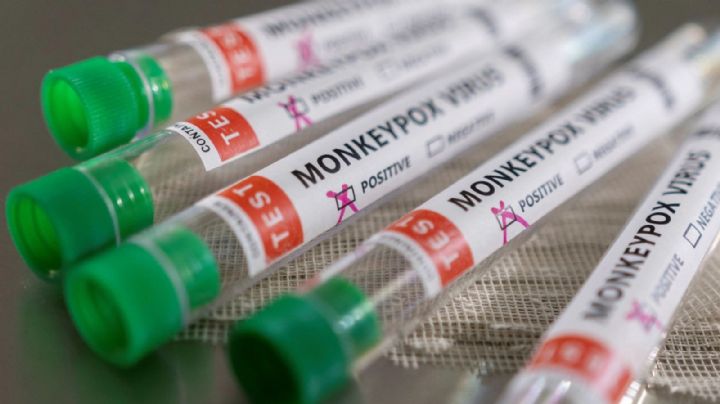 Aumentan los casos de viruela del mono en países no endémicos: la OMS actualizó la cifra