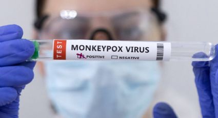 España logró obtener la secuencia completa del virus de la viruela del mono