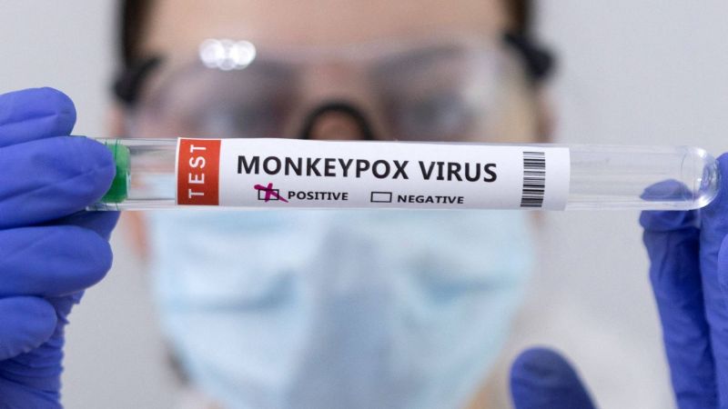 España logró obtener la secuencia completa del virus de la viruela del mono