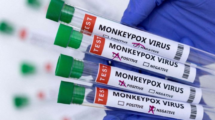 Por primera vez, Estados Unidos detectó casos de viruela del mono en niños