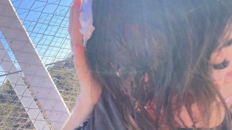 Parque Norte: atacaron a una mujer con una piedra